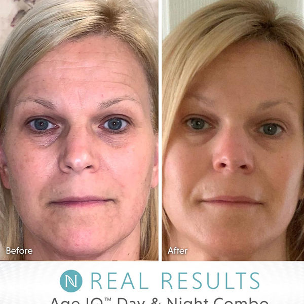 Age IQ® Night Cream