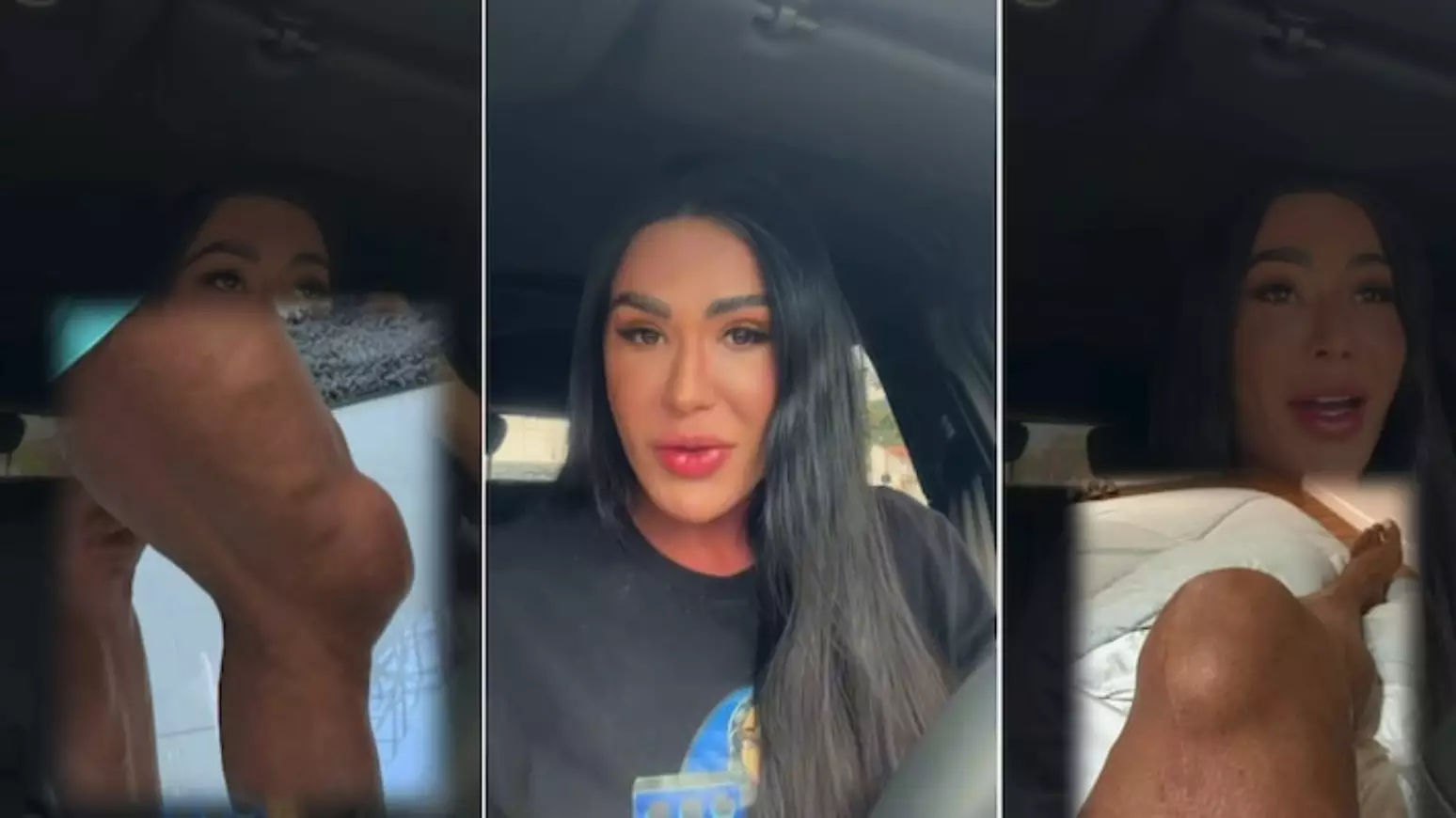 Gracyanne Barbosa mostra o joelho inchado em vídeo publicado nas redes sociais