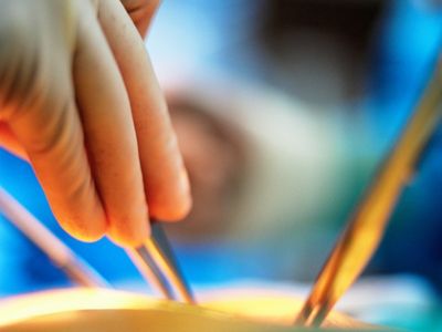 ידיים של מנתח במהלך ניתוח