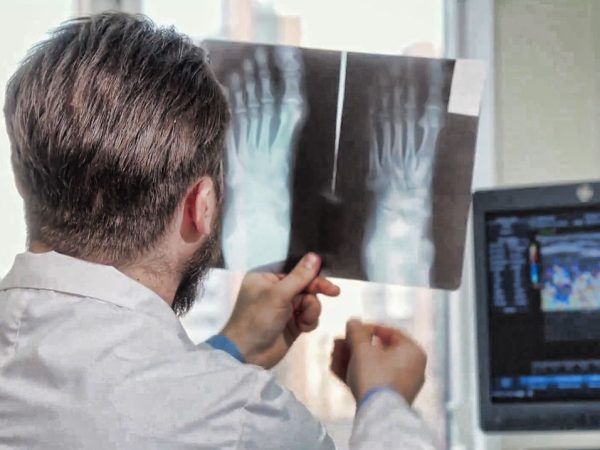 Las lesiones más comunes en corredores y cómo evitarlas