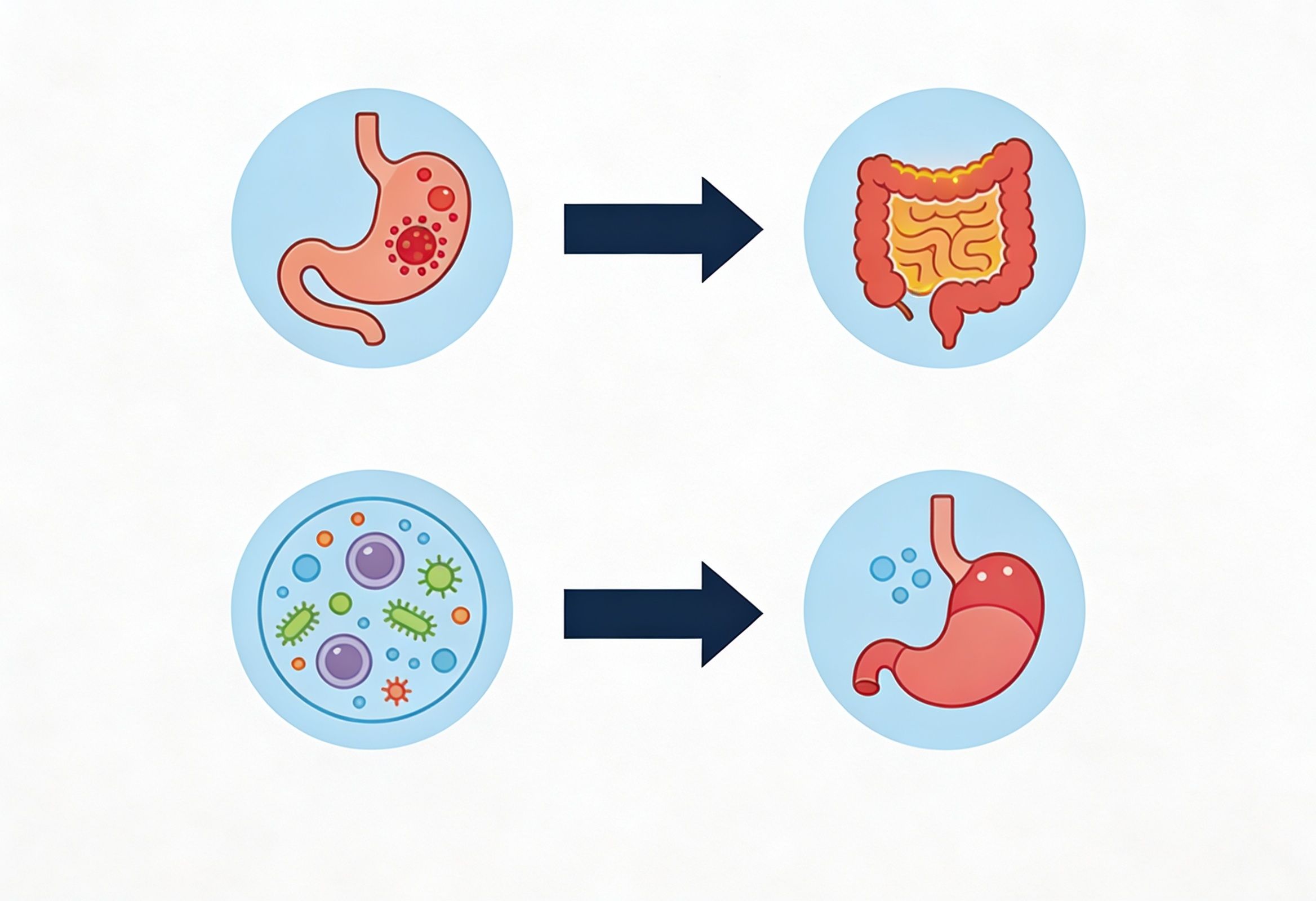 Infographic showing how a stomach infection progresses into post-infectious IBS through inflammation and microbiome disruption.jpeg