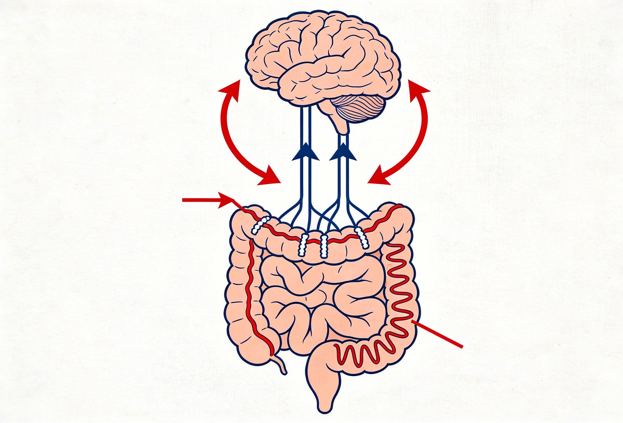 Visual representation of the gut-brain axis showing how stress affects gut motility and exacerbates post-infectious IBS symptoms..jpeg