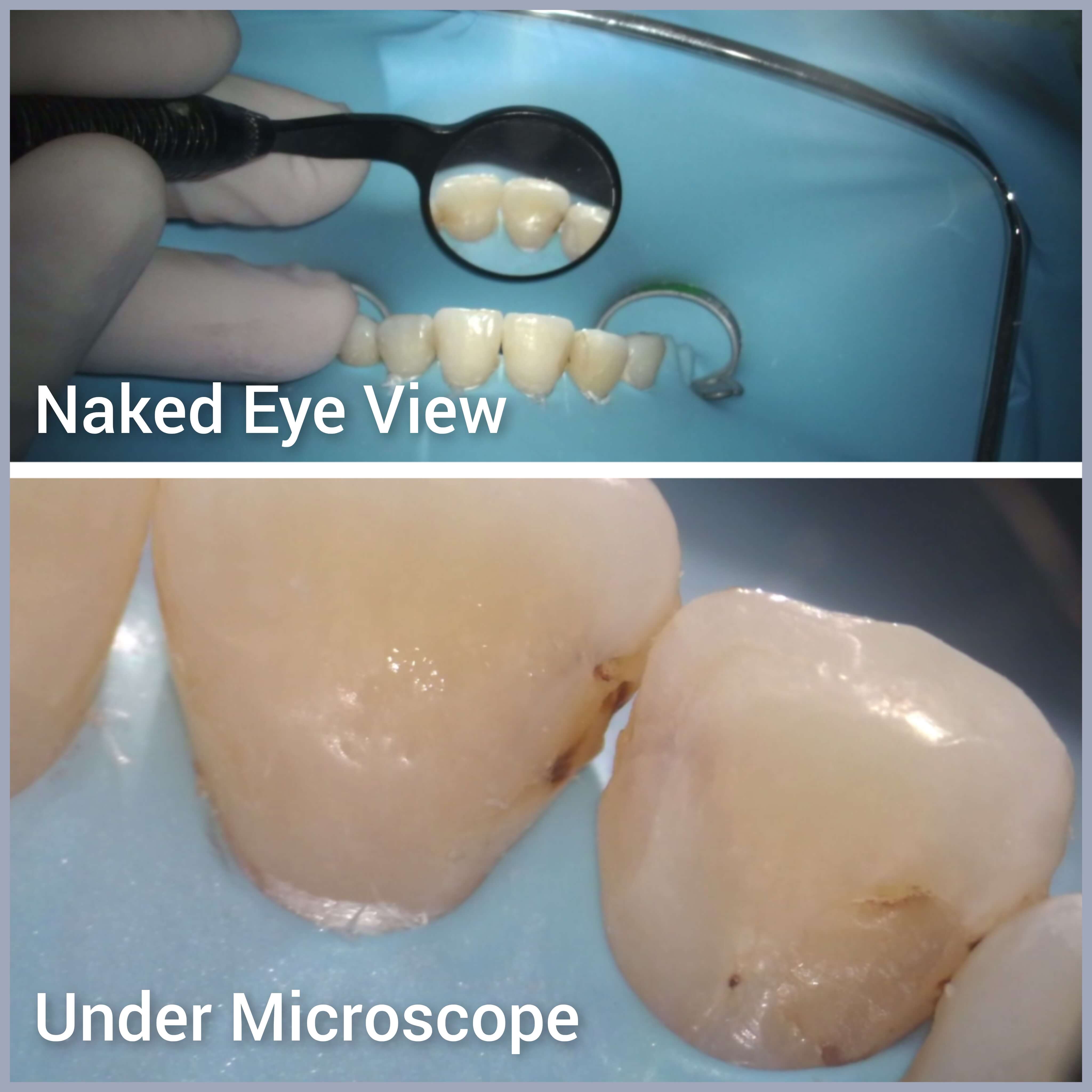 Advanced dental microscope technology