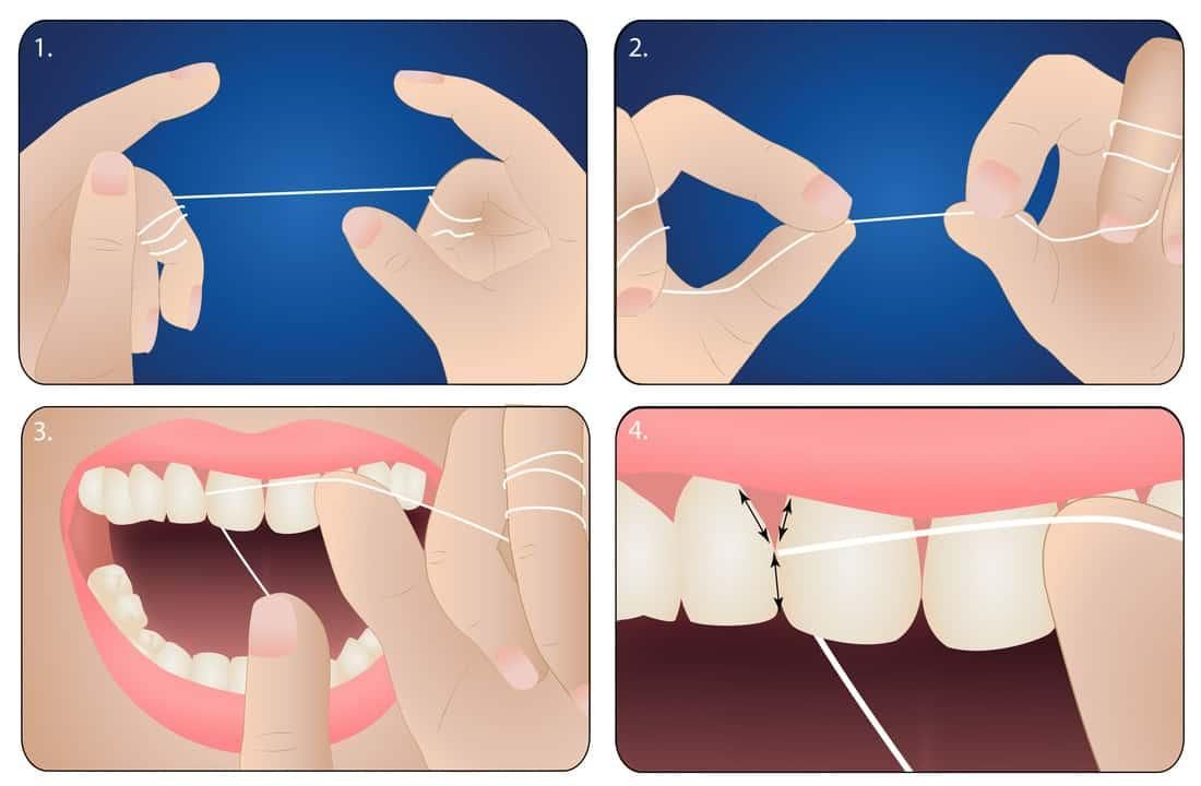 Modern denture solutions