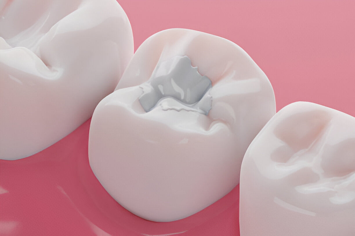 Modern denture solutions