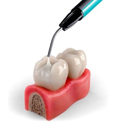 Modern denture solutions