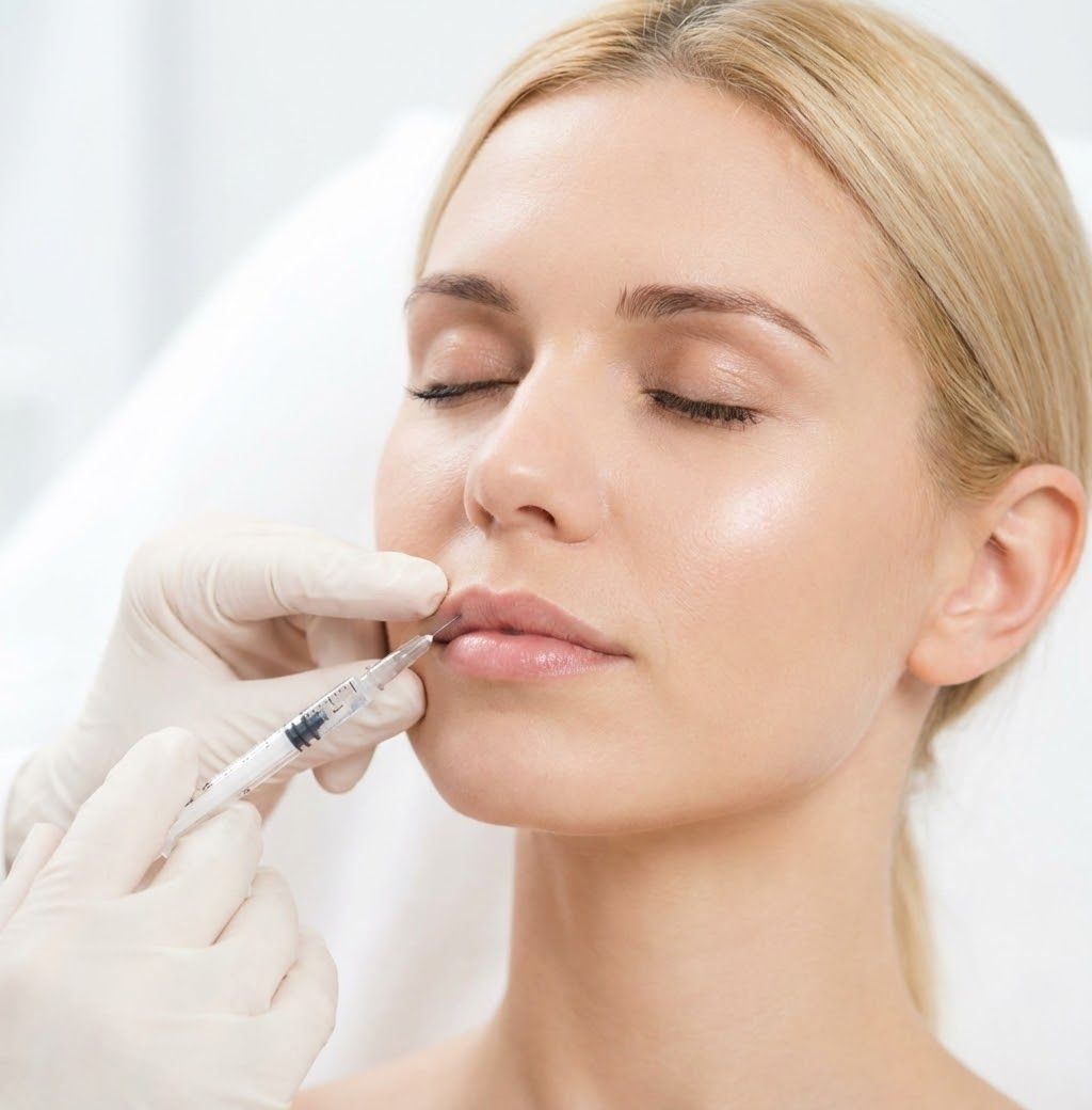 Injection d’acide hyaluronique dans les lèvres d’une patiente détendue, les yeux fermés
