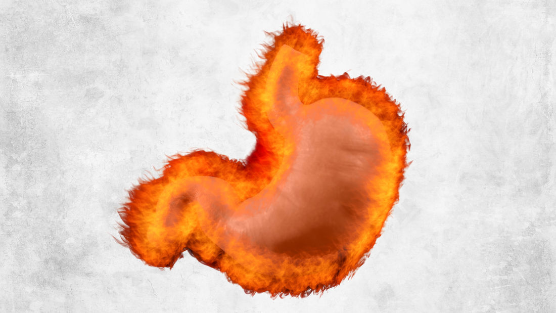 Gastritis