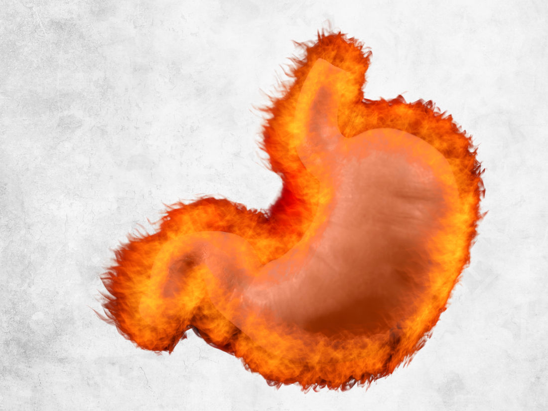 Gastritis