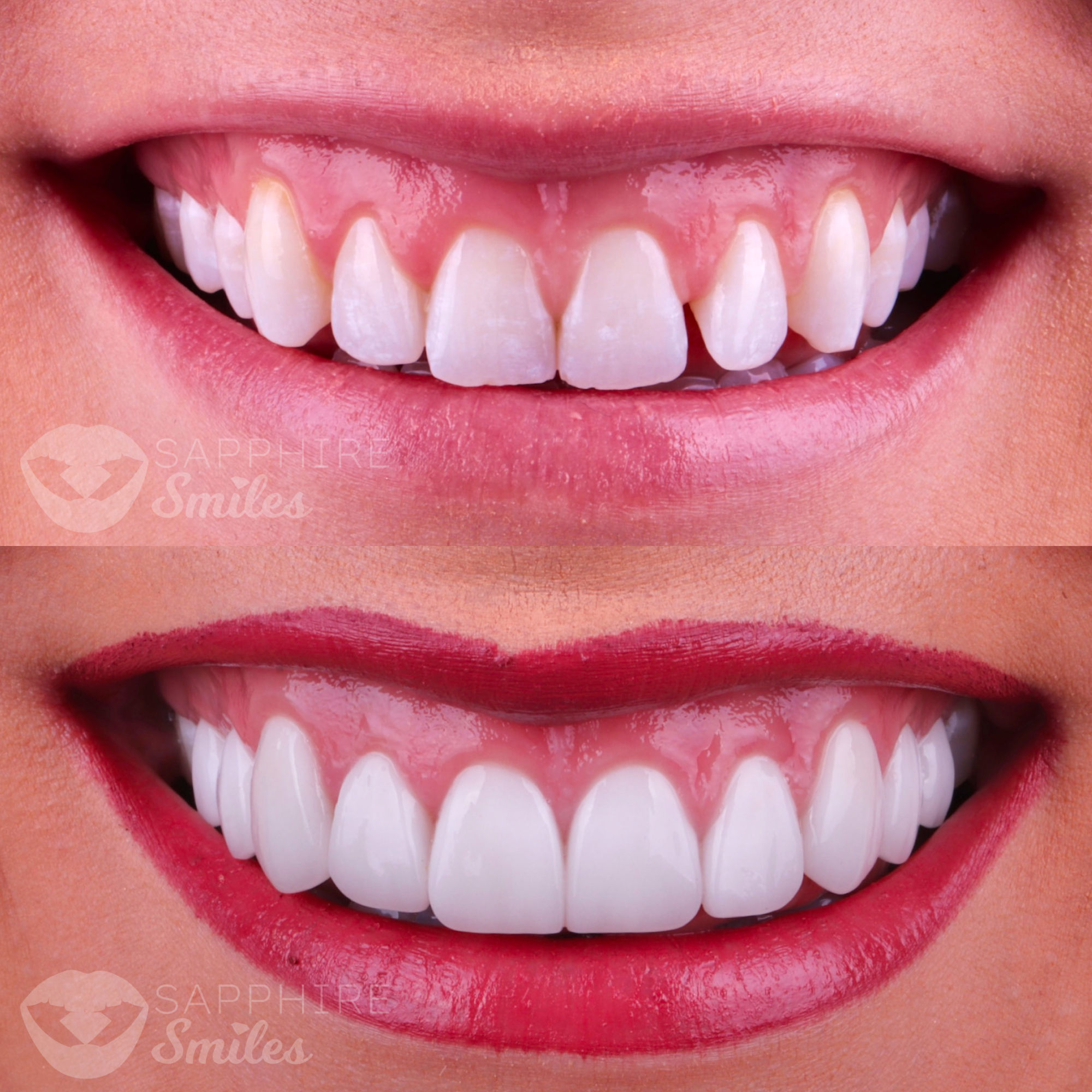 Patient before and after photos