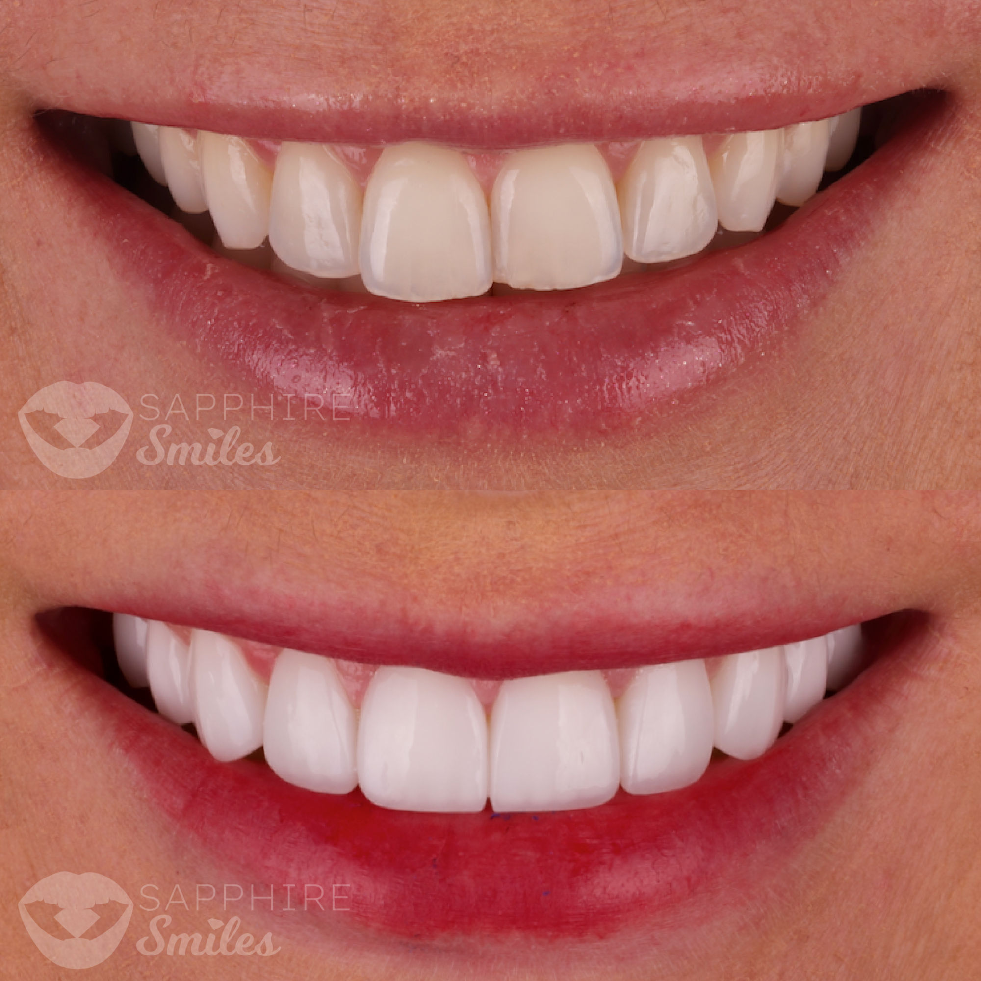 Patient before and after photos