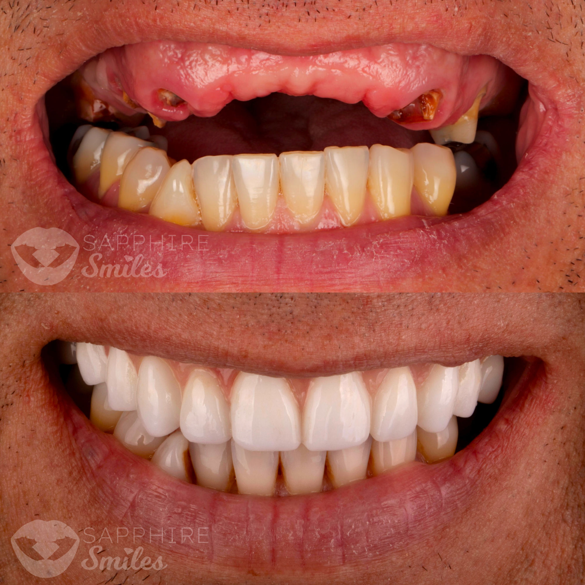 Patient before and after photos