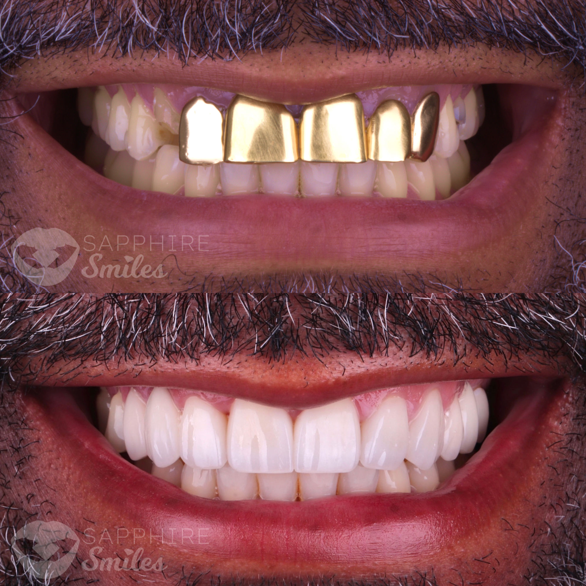 Patient before and after photos
