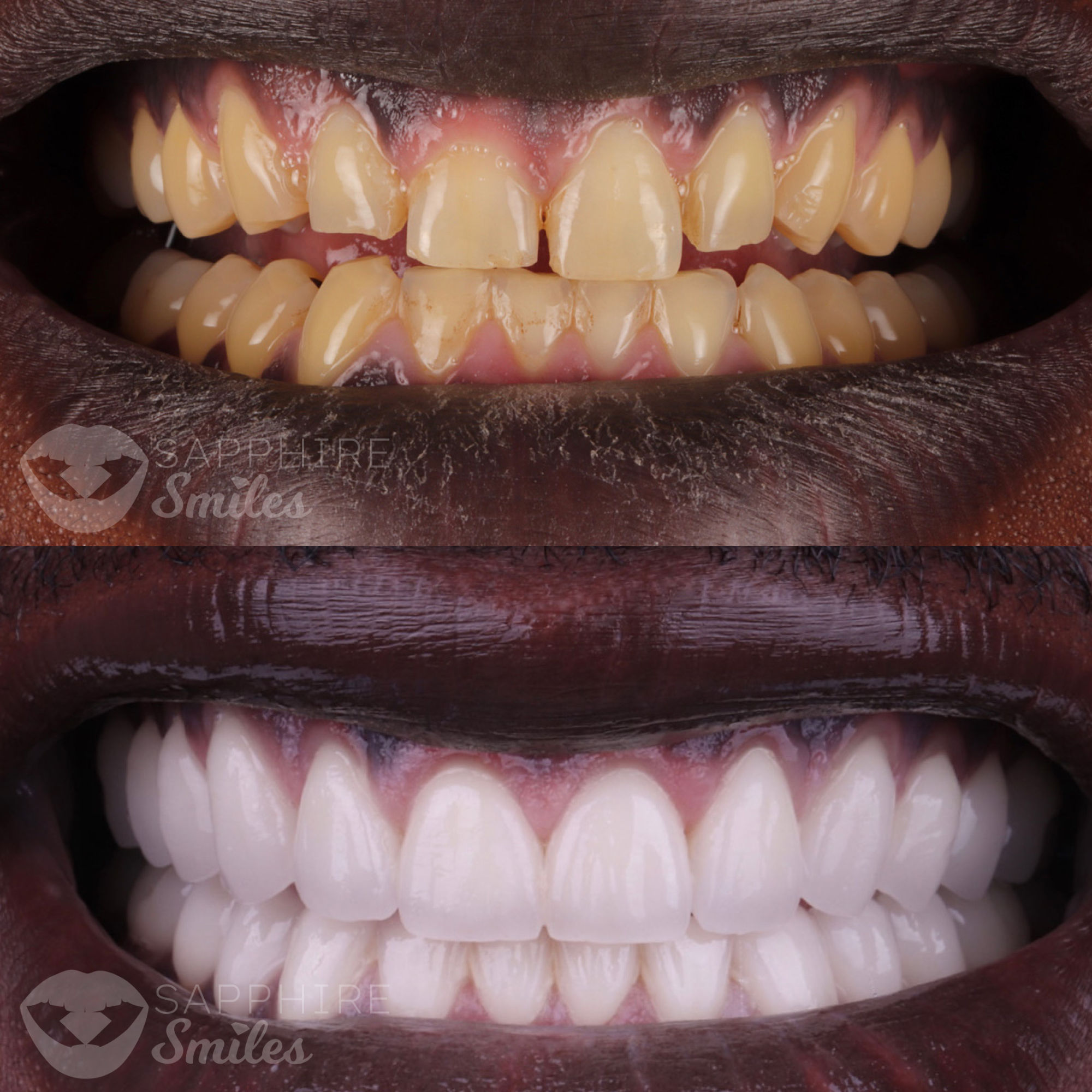 Patient before and after photos