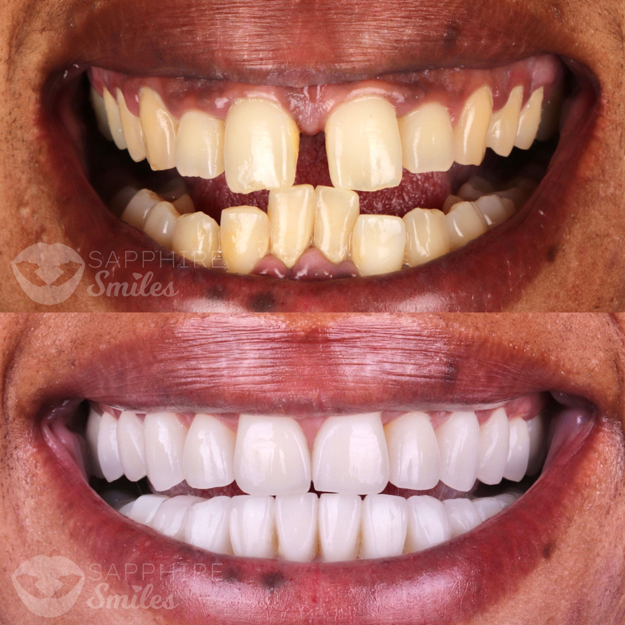 Patient before and after photos