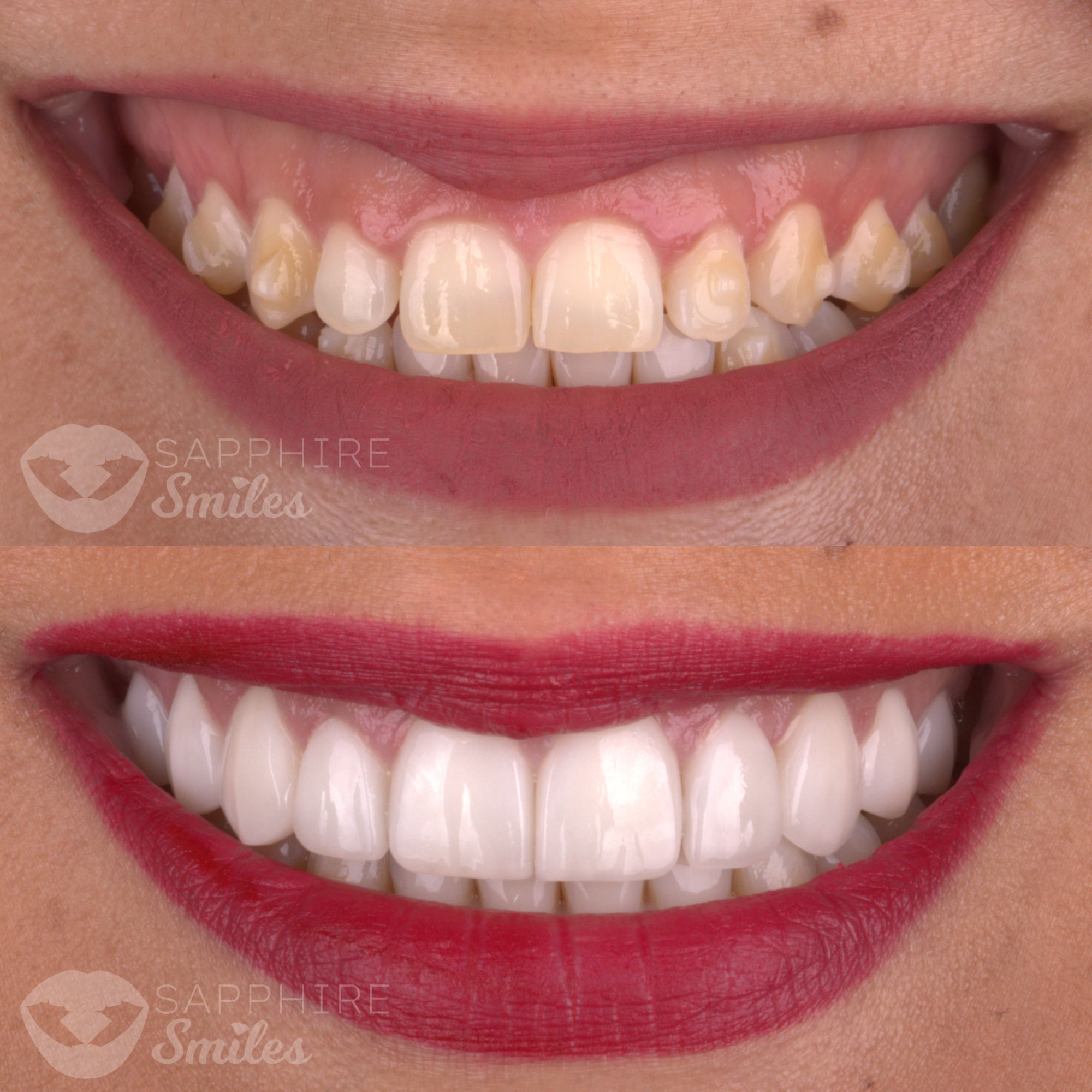 Patient before and after photos