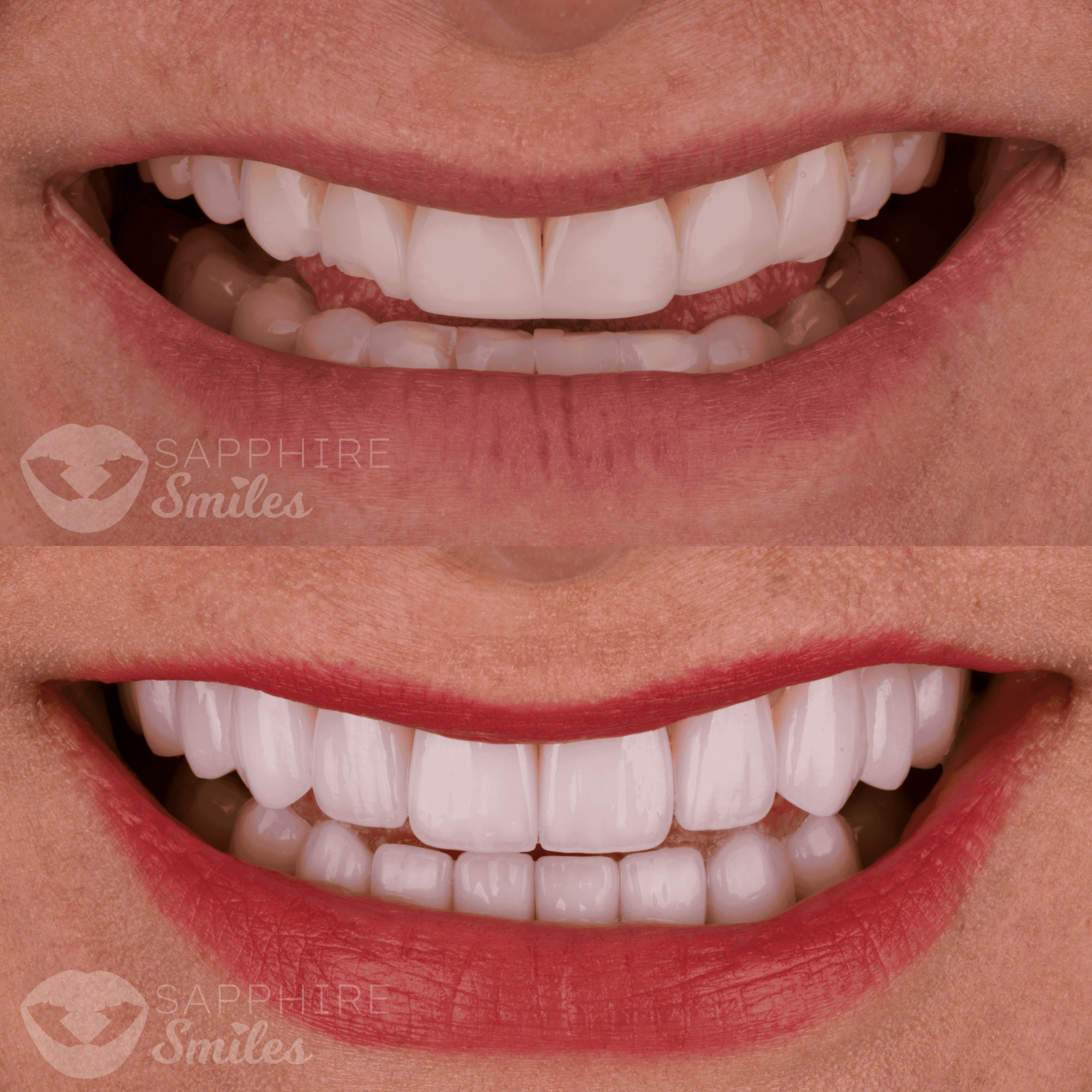 Patient before and after photos