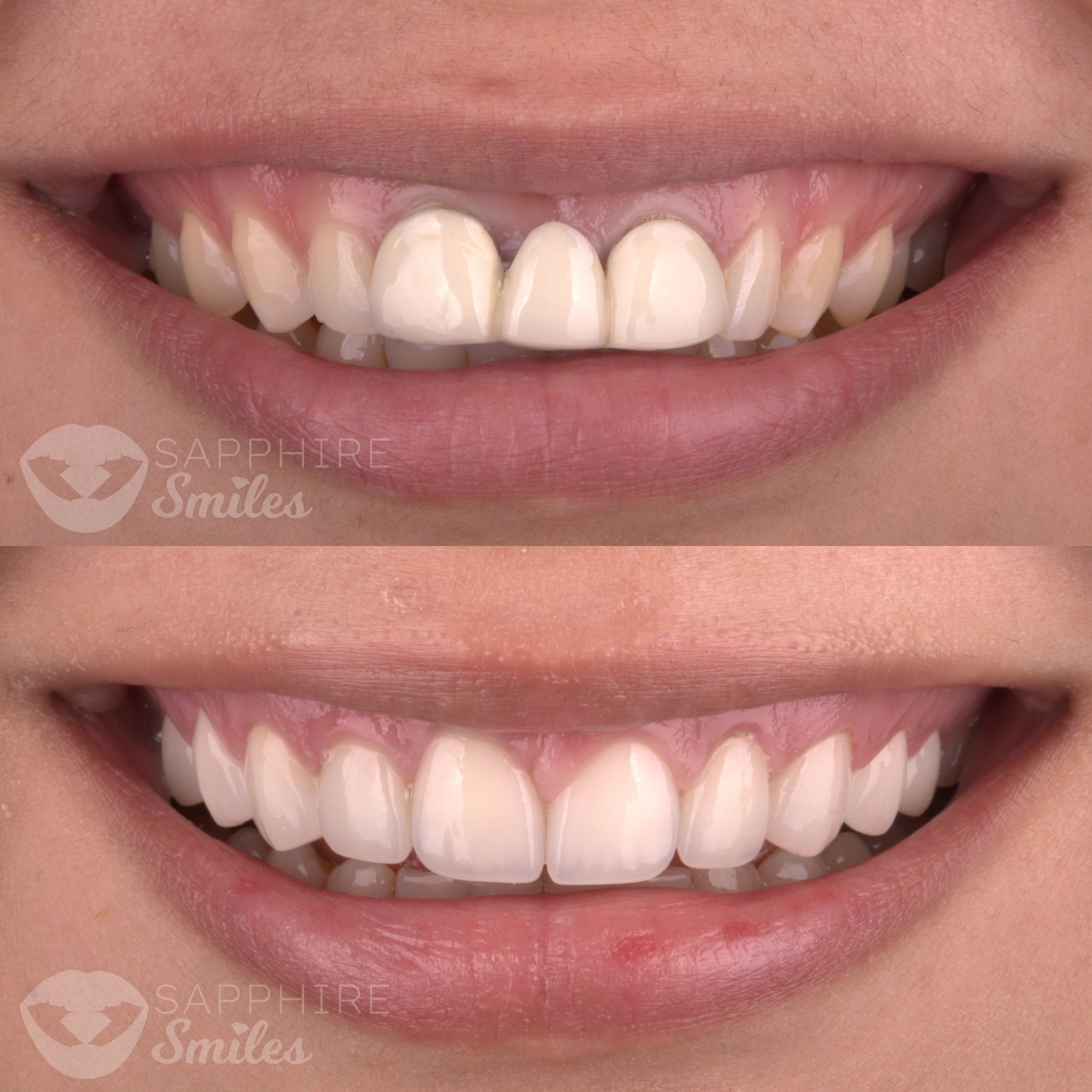 Patient before and after photos