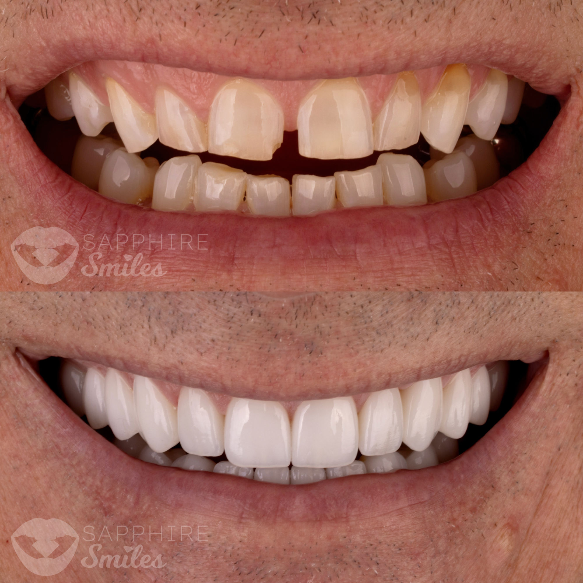 Patient before and after photos