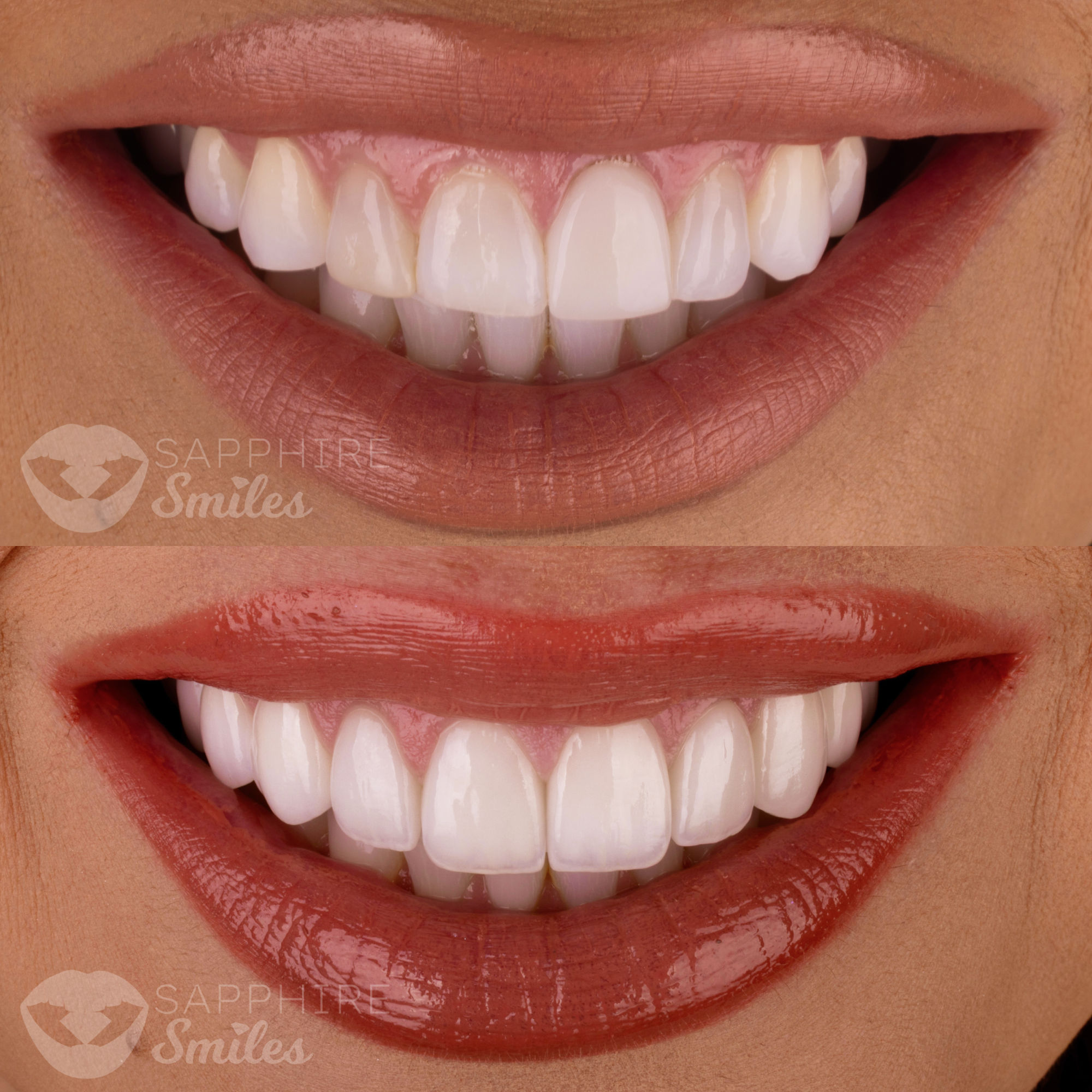 Patient before and after photos