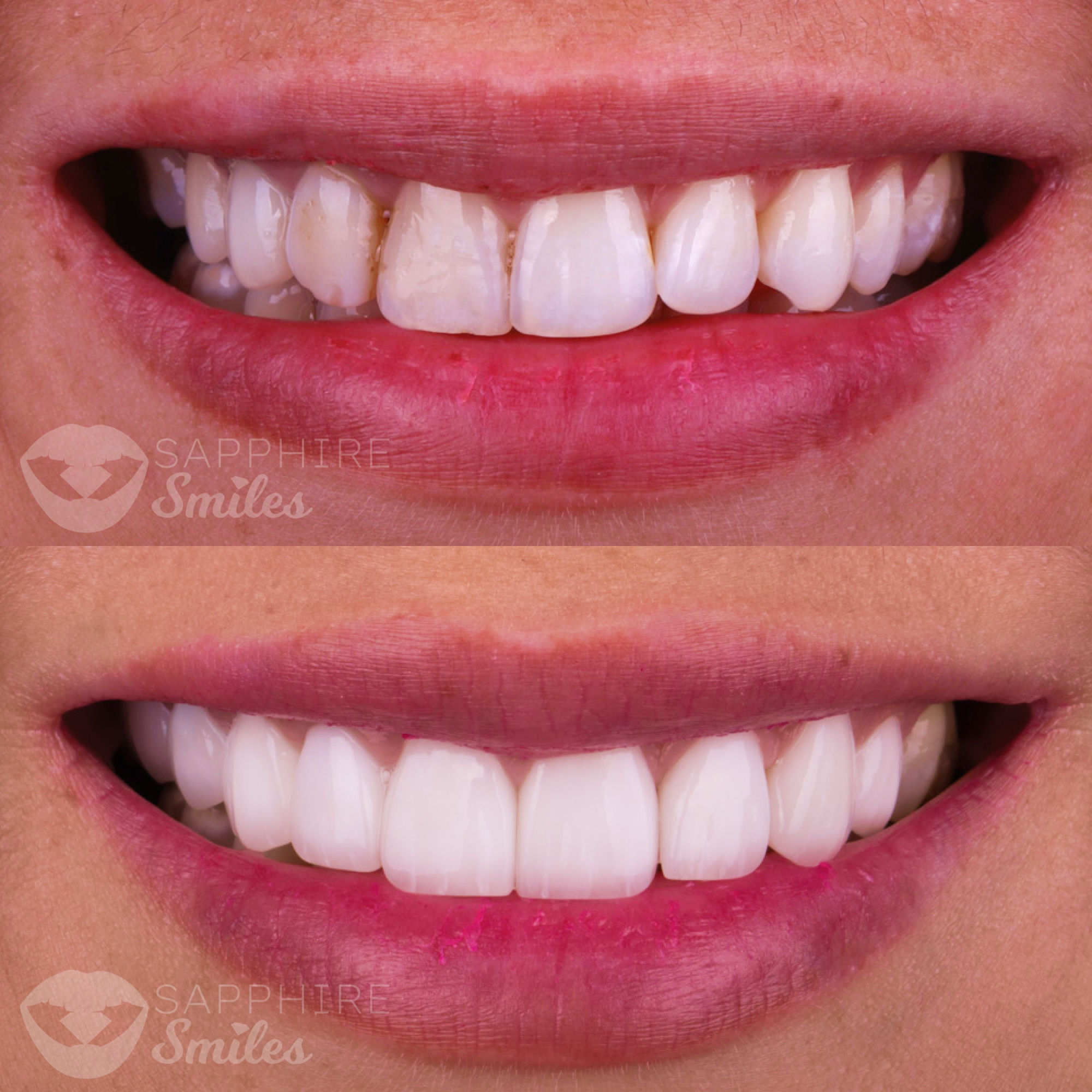 Patient before and after photos