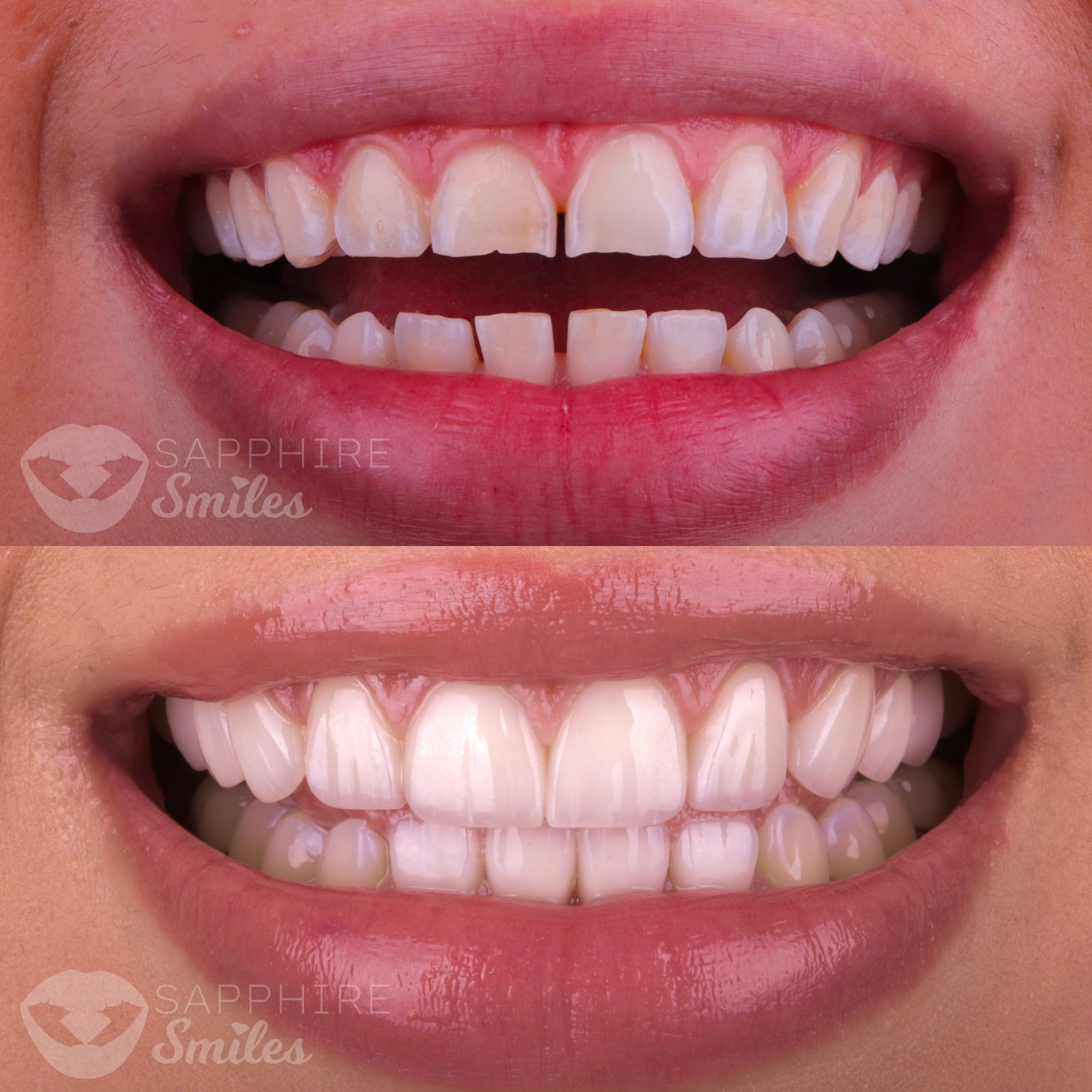 Patient before and after photos