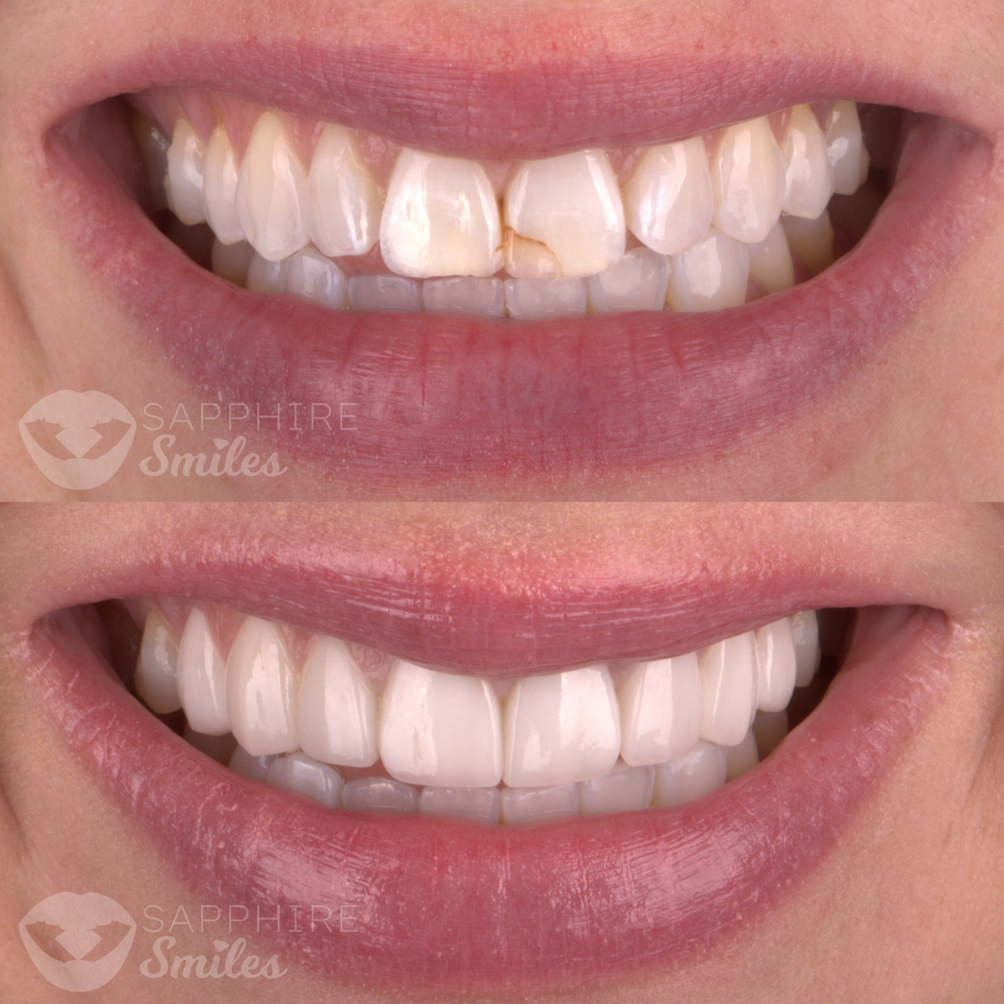 Patient before and after photos
