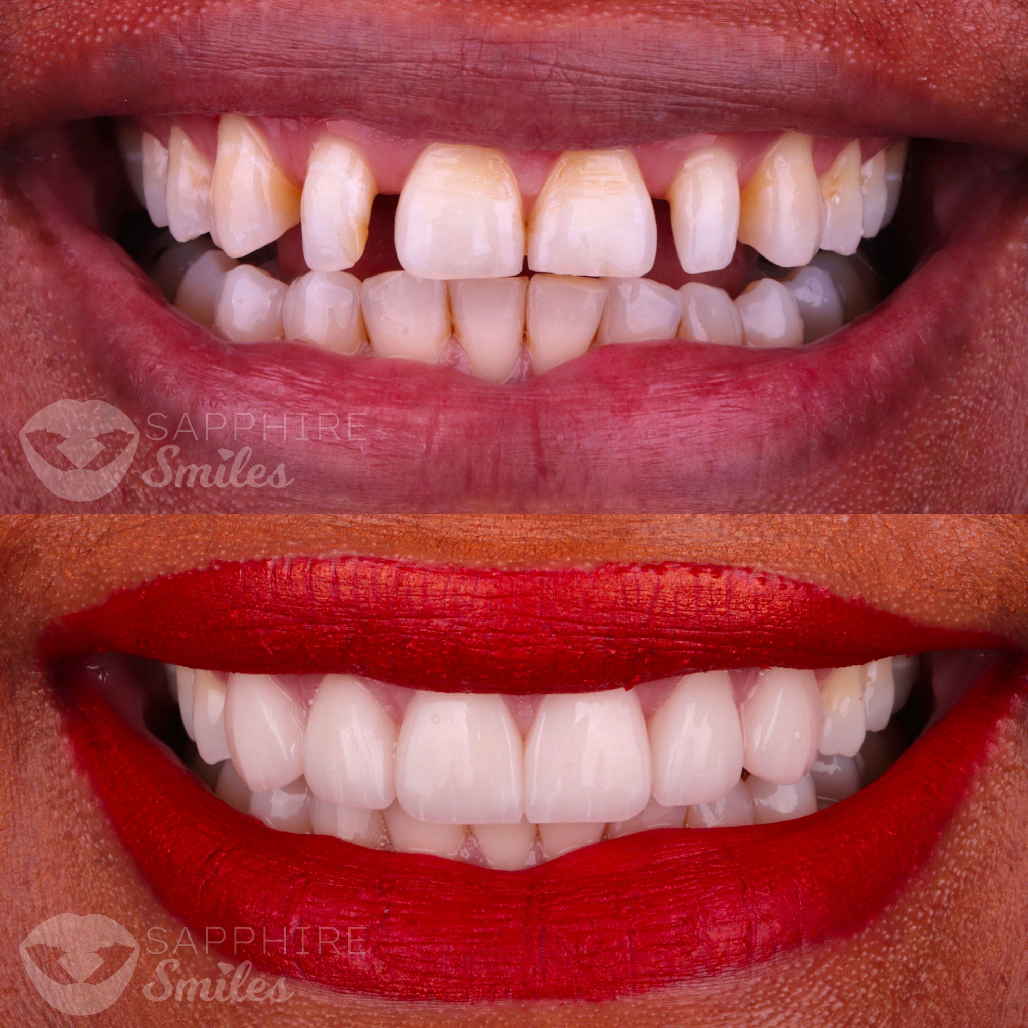 Patient before and after photos