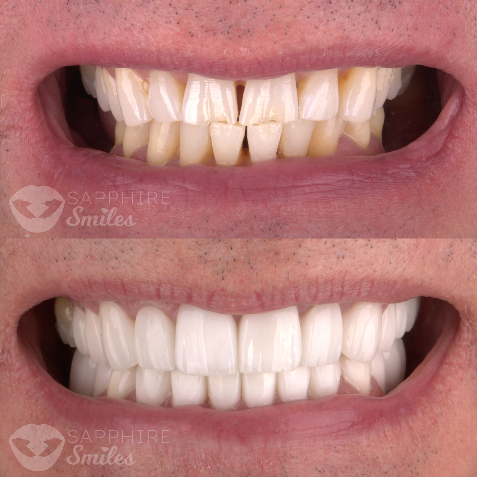 Patient before and after photos
