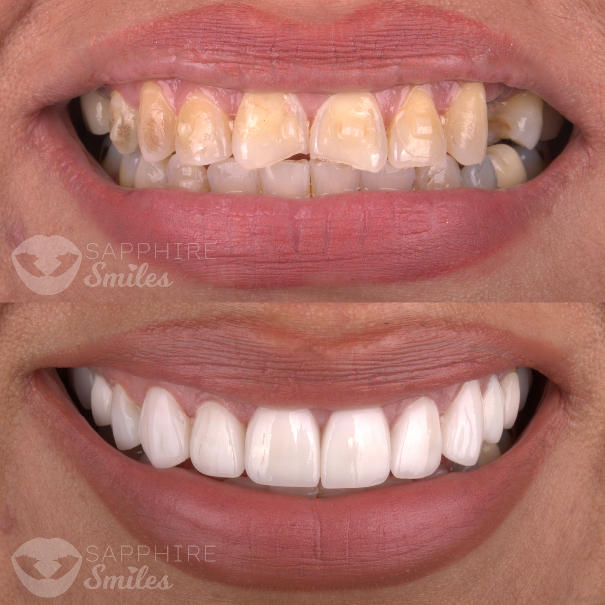Patient before and after photos