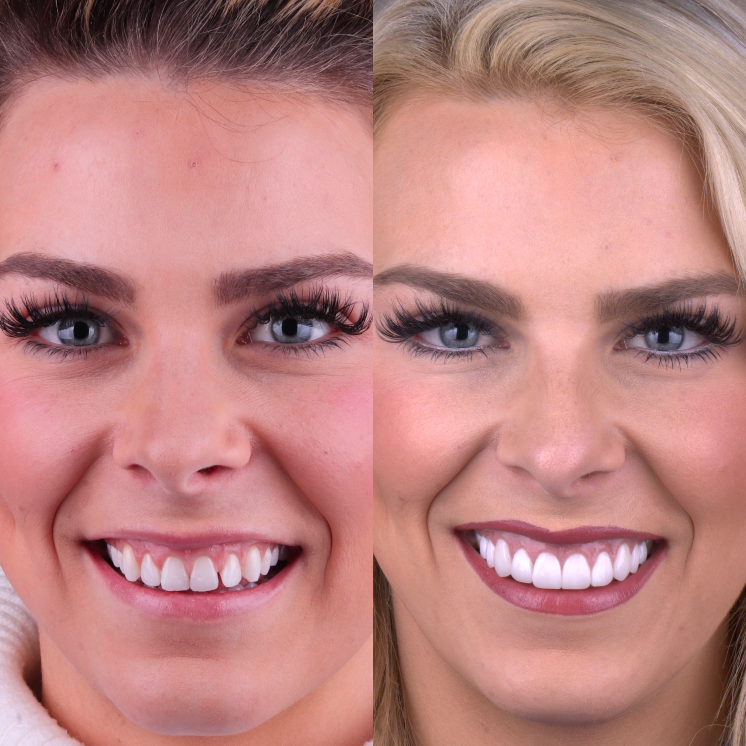 Patient before and after photos