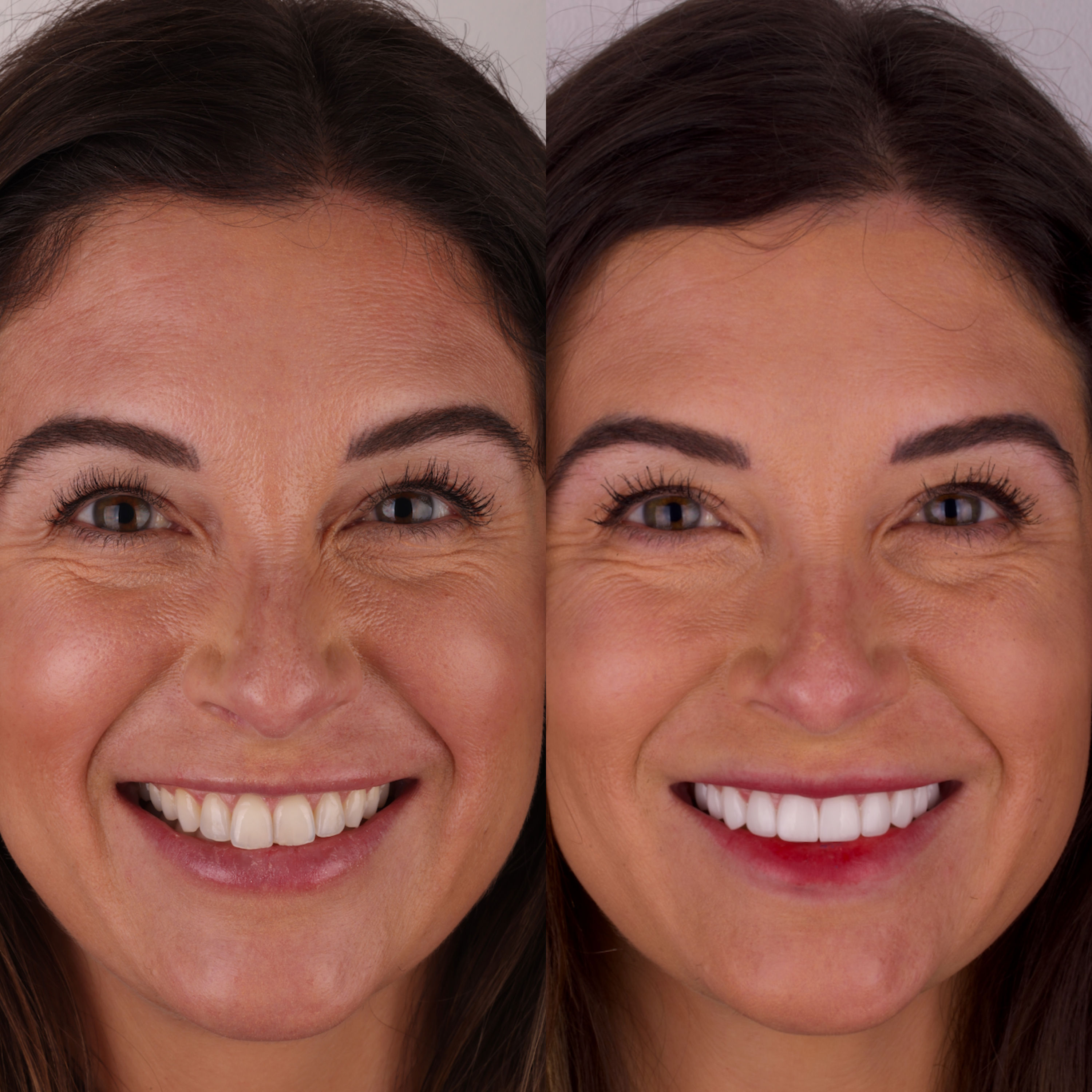 Patient before and after photos