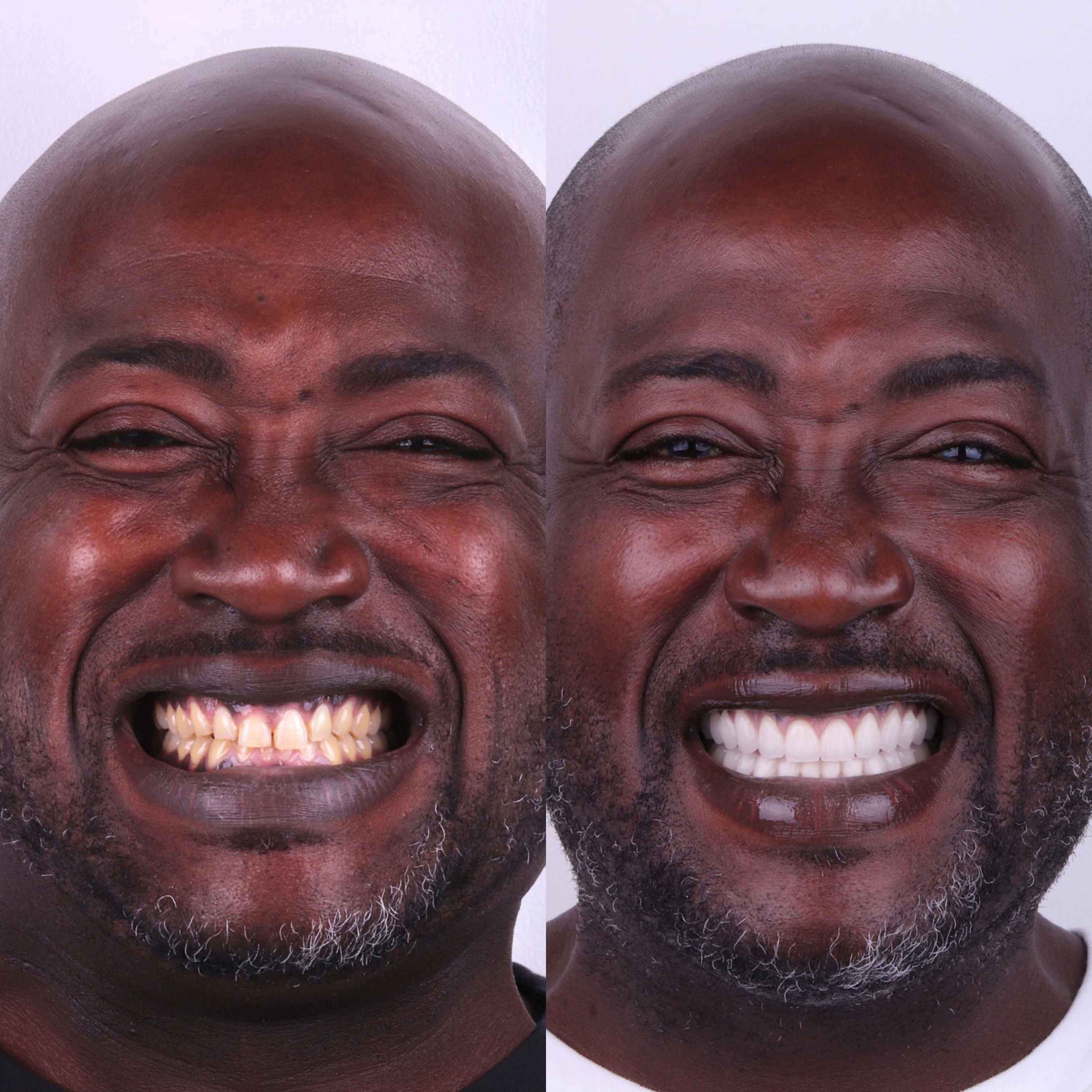Patient before and after photos