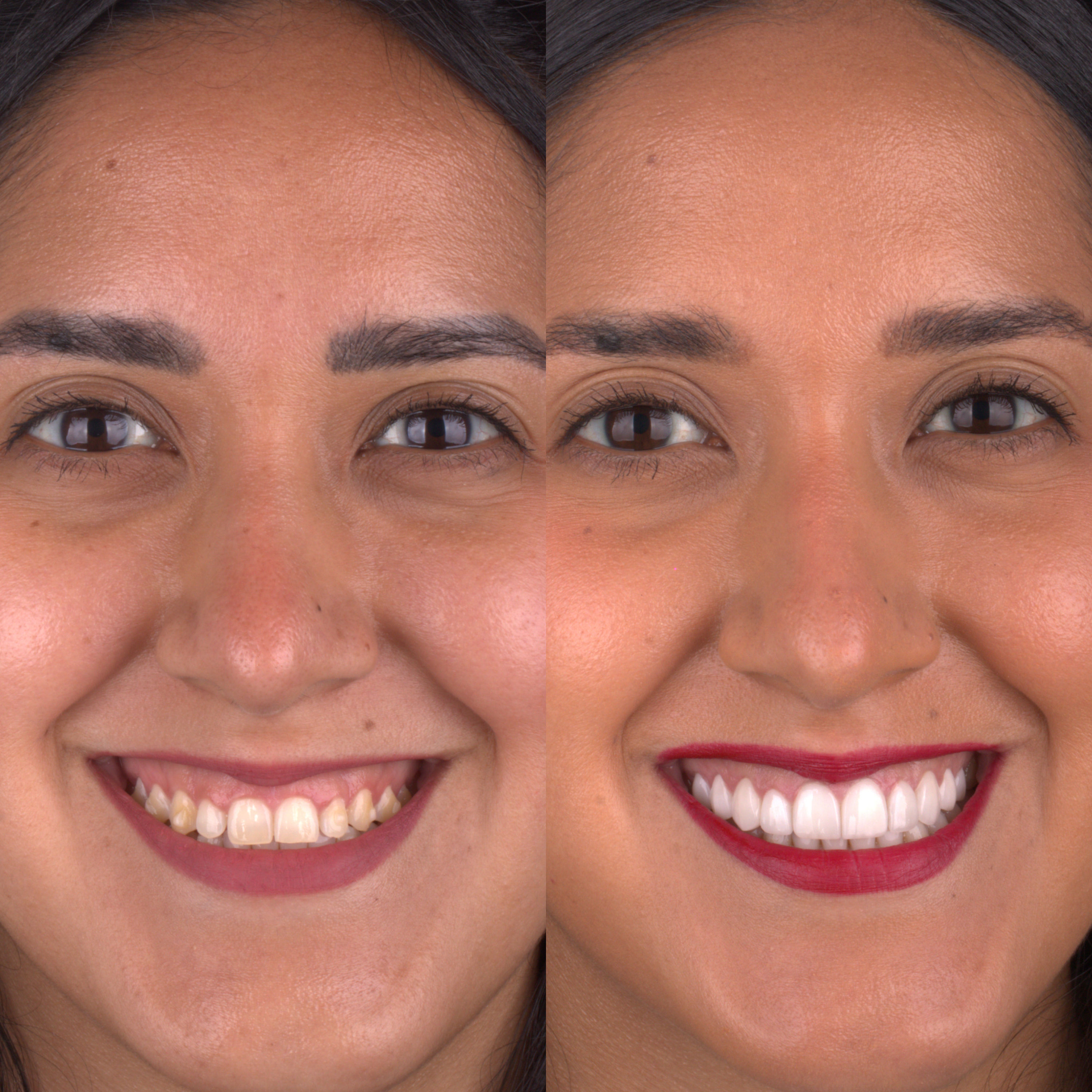 Patient before and after photos