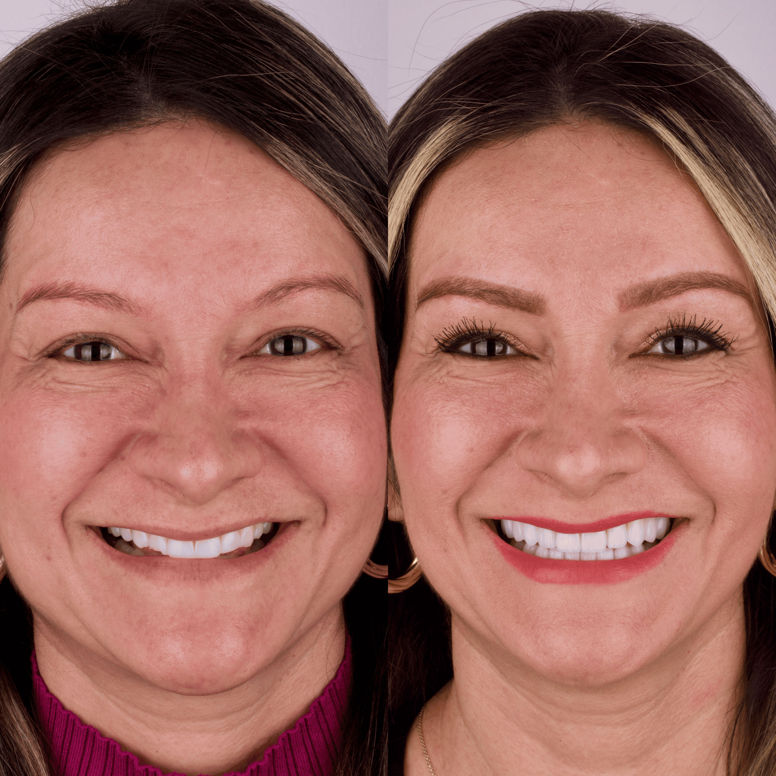 Patient before and after photos