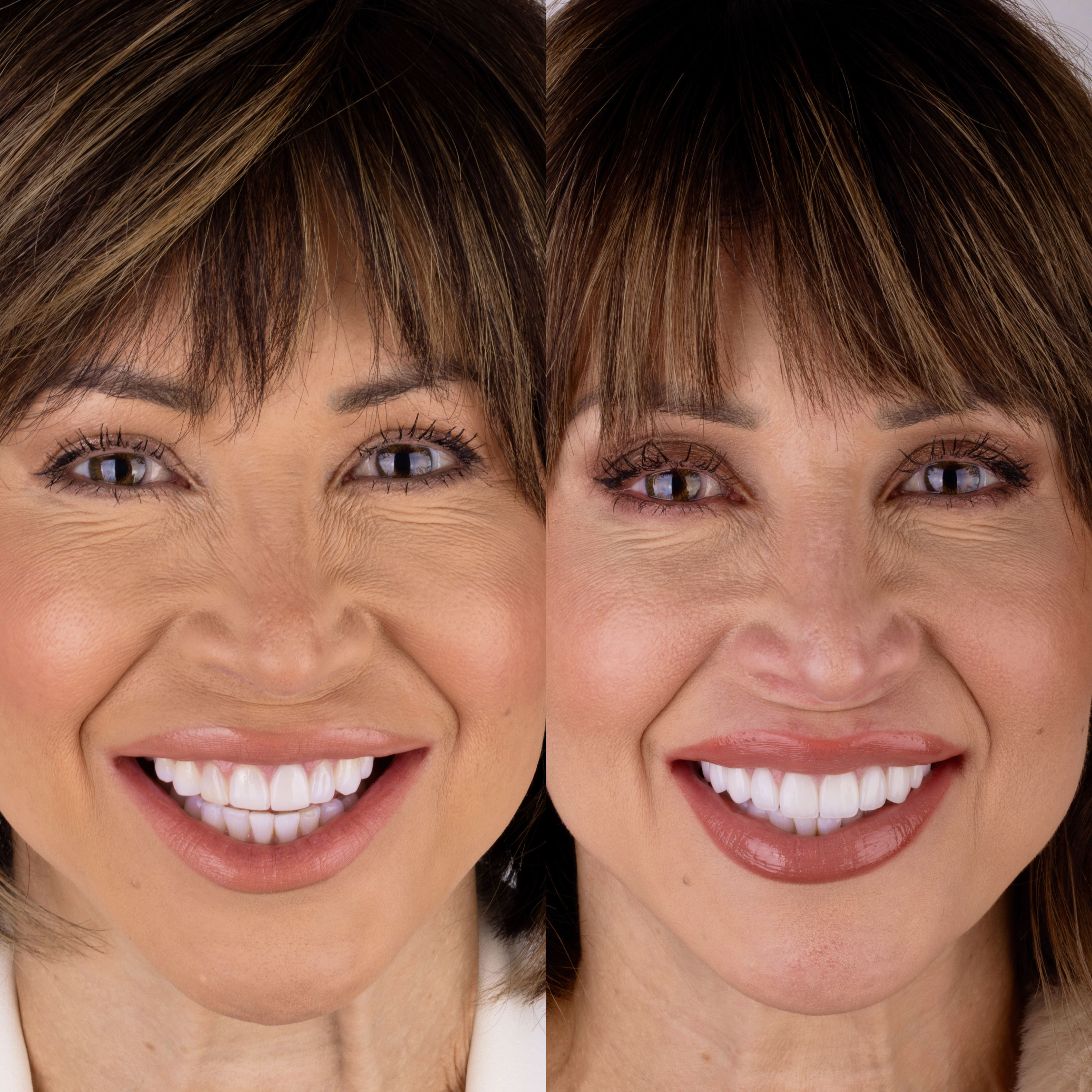 Patient before and after photos