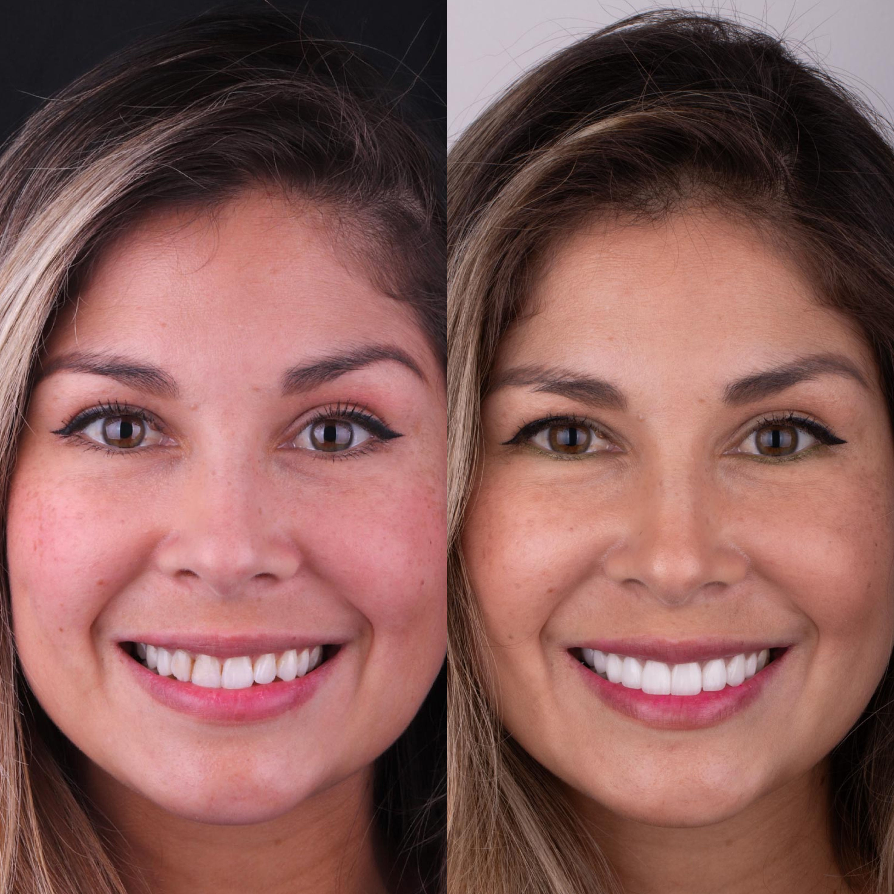 Patient before and after photos