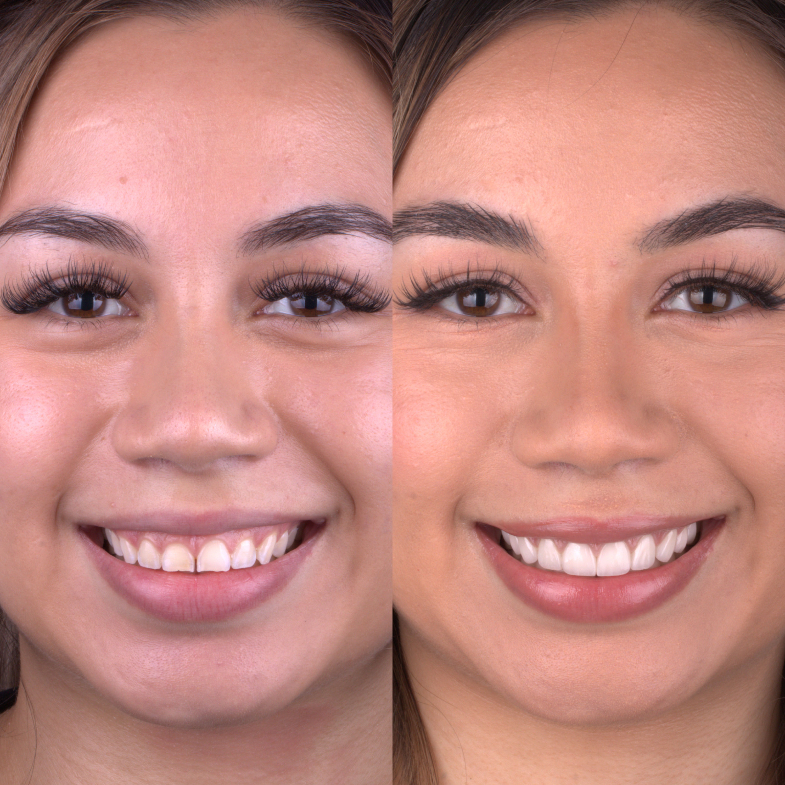 Patient before and after photos