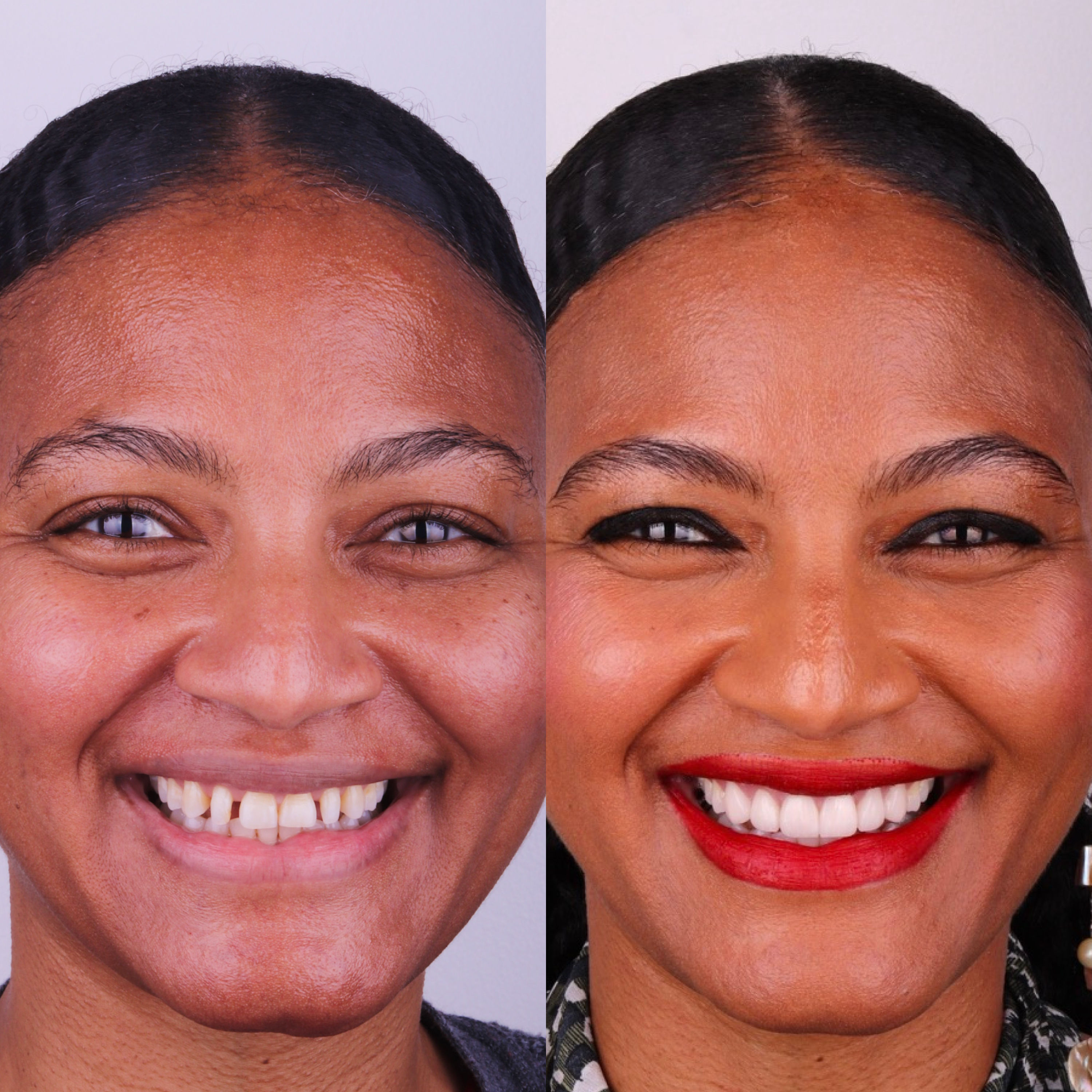 Patient before and after photos