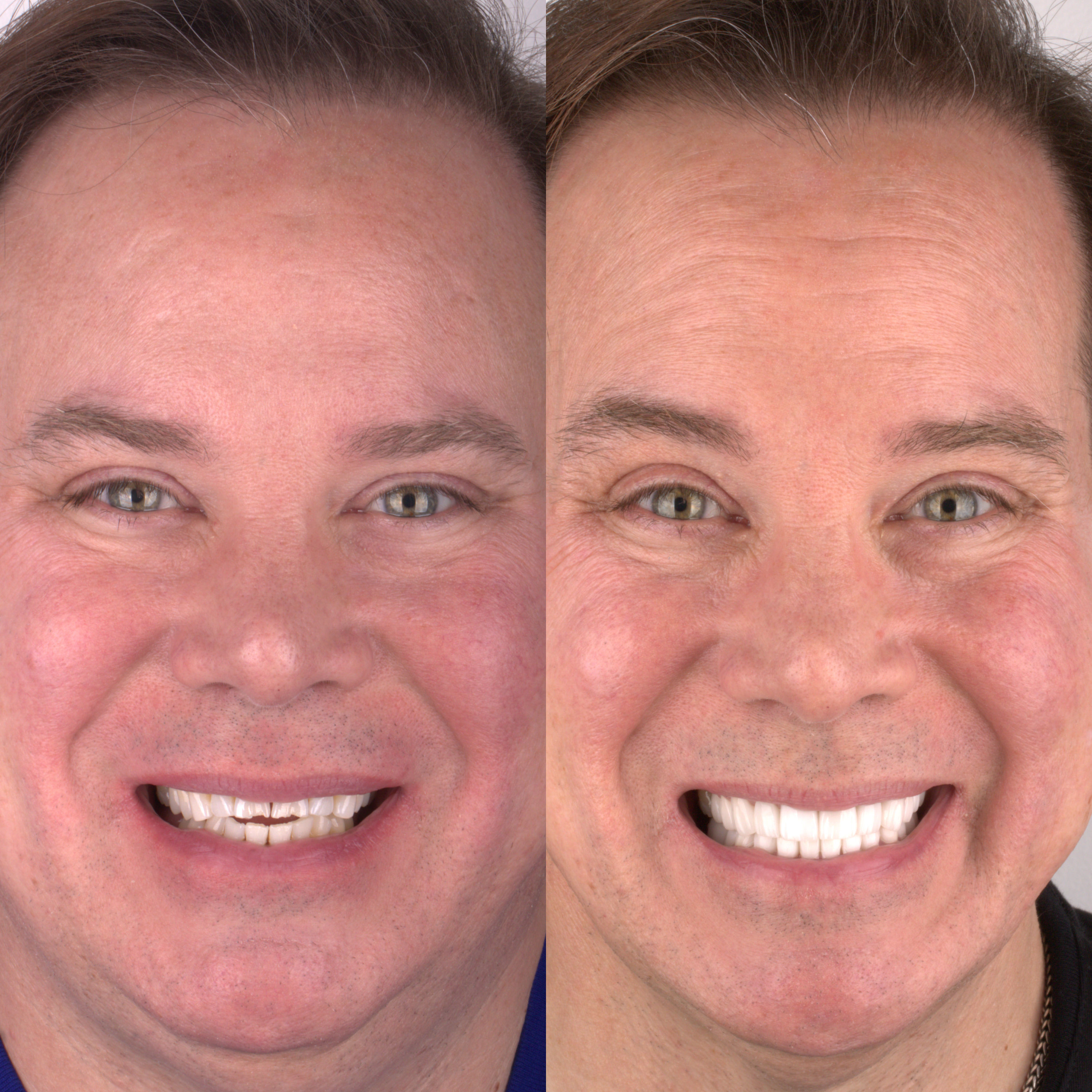 Patient before and after photos