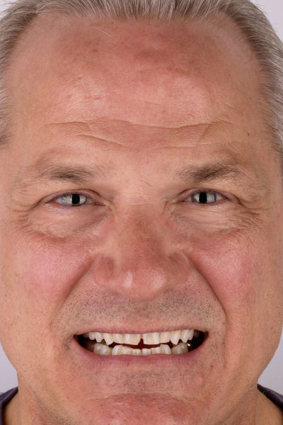 Patient before and after photos