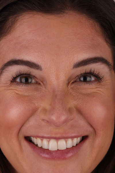 Patient before and after photos