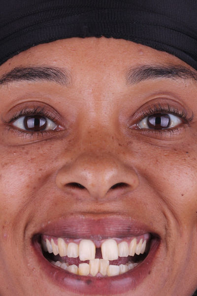 Patient before and after photos