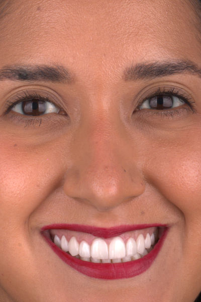 Patient before and after photos