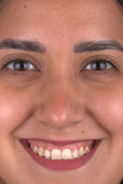 Patient before and after photos