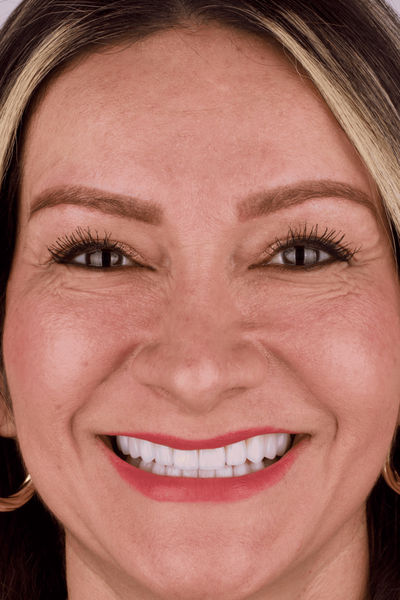Patient before and after photos