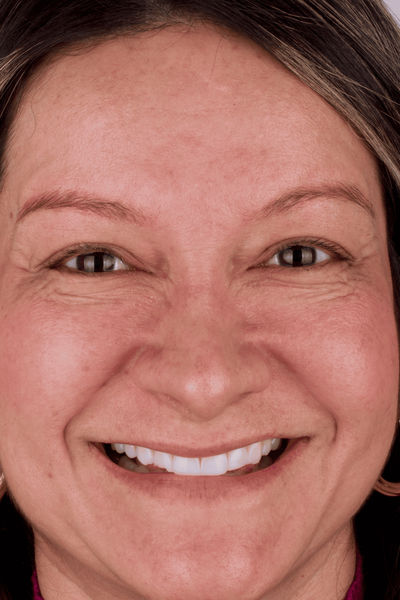 Patient before and after photos
