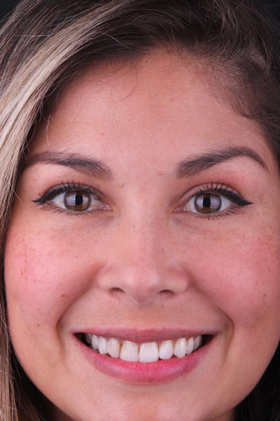 Patient before and after photos