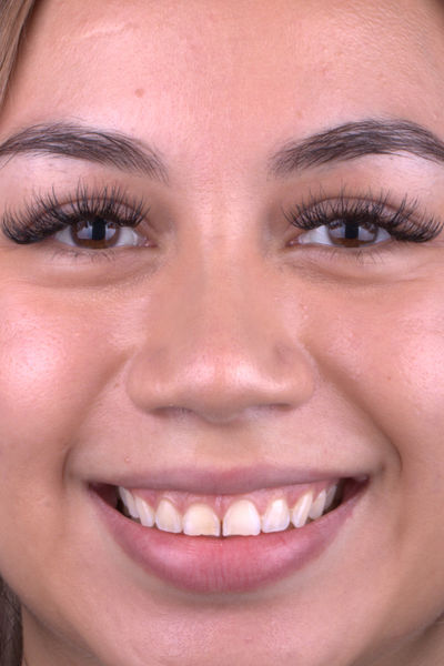 Patient before and after photos