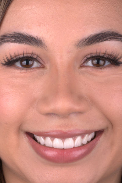 Patient before and after photos